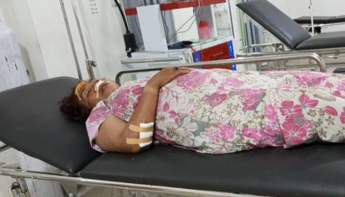 Jalan Gelap dan Berlubang, Wartawan Senior Tulang Bawang Barat Alami Kecelakaan Serius 